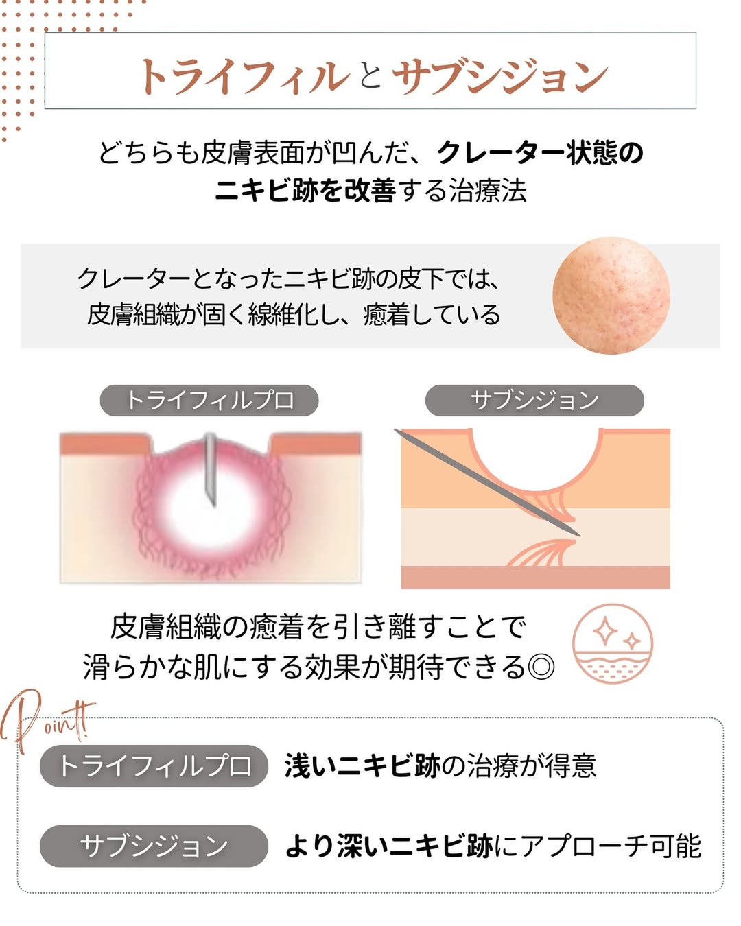 トライフィルプロとサブシジョン