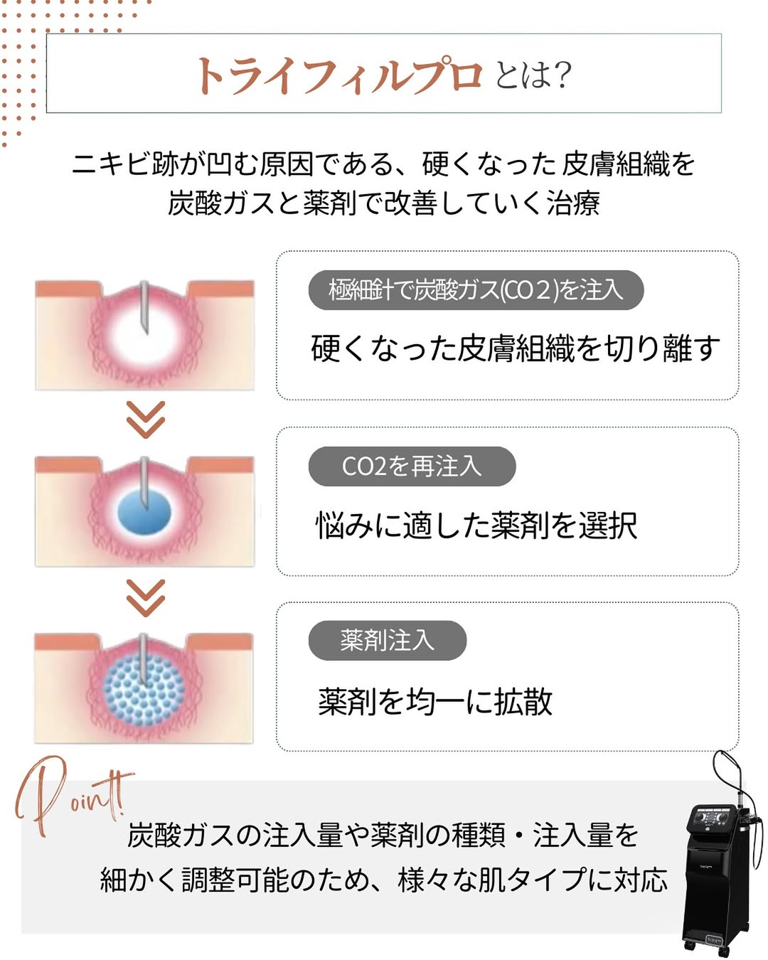 トライフィルプロ施術の流れ