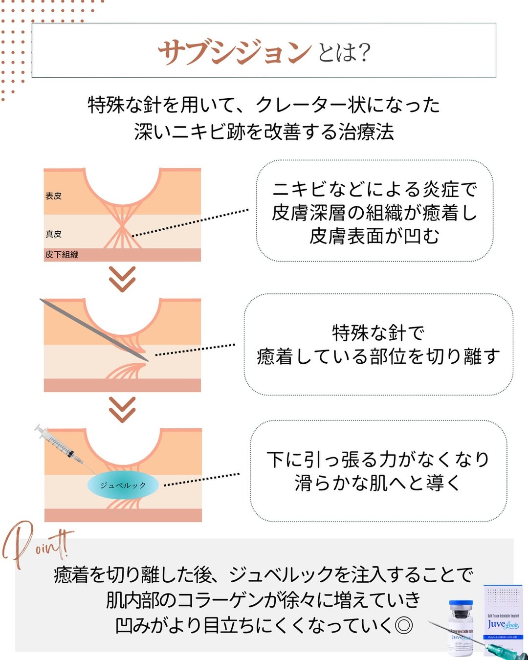 サブシジョン施術の流れ