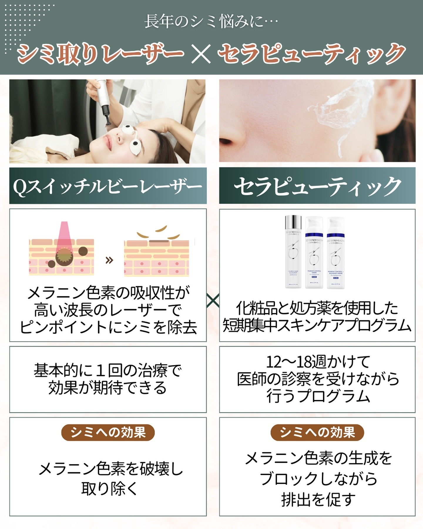 シミ取りレーザー セラピューティック 効果