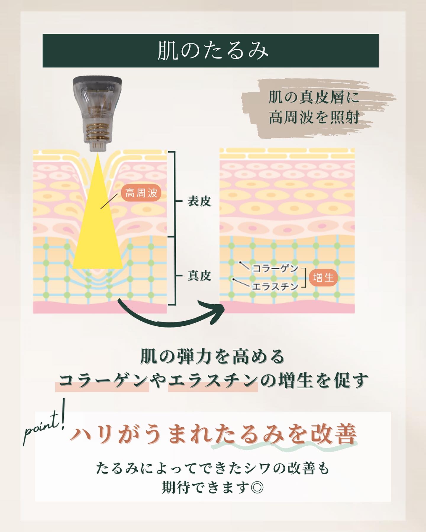 ポテンツァ たるみ
