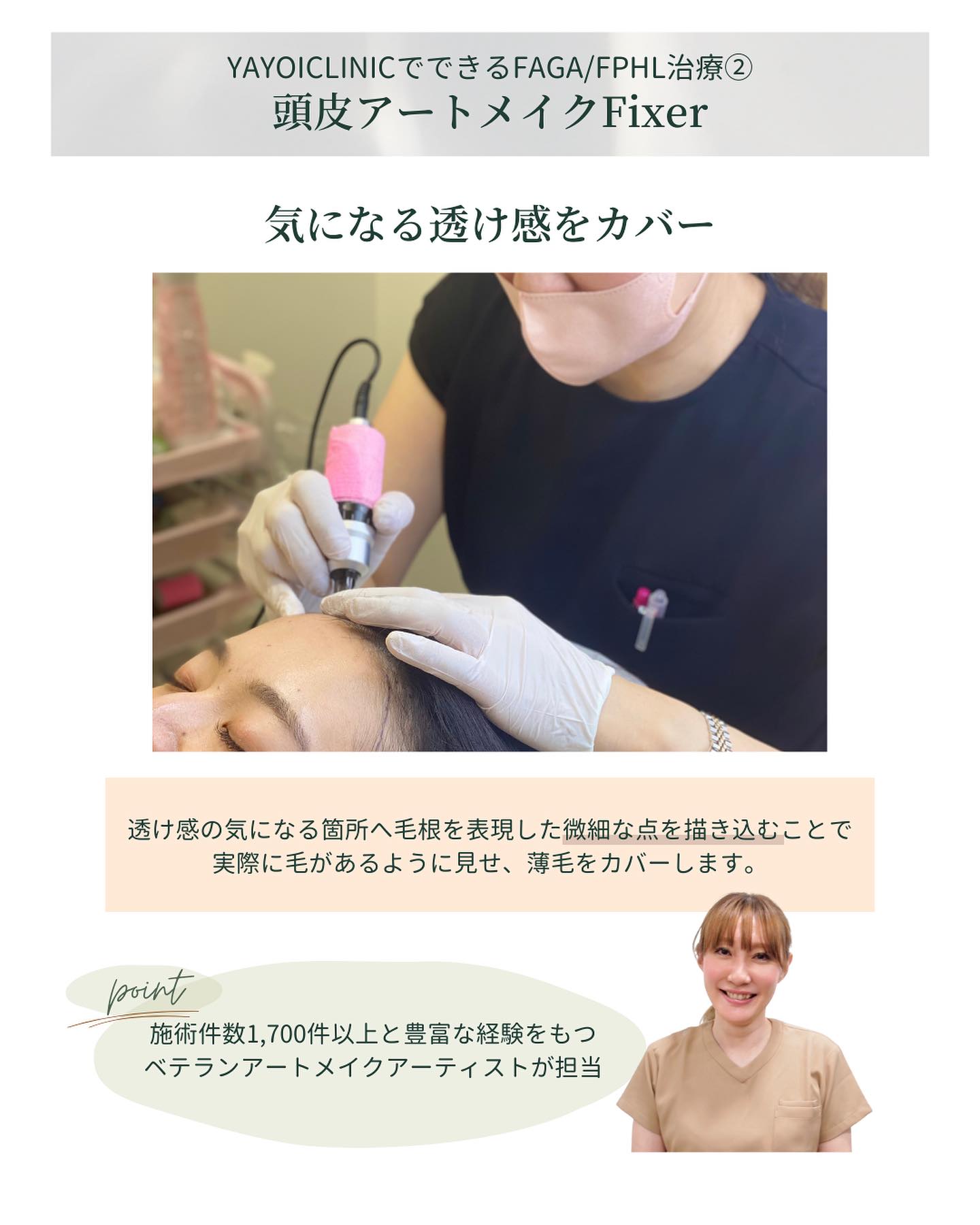 頭皮アートメイクFixer
