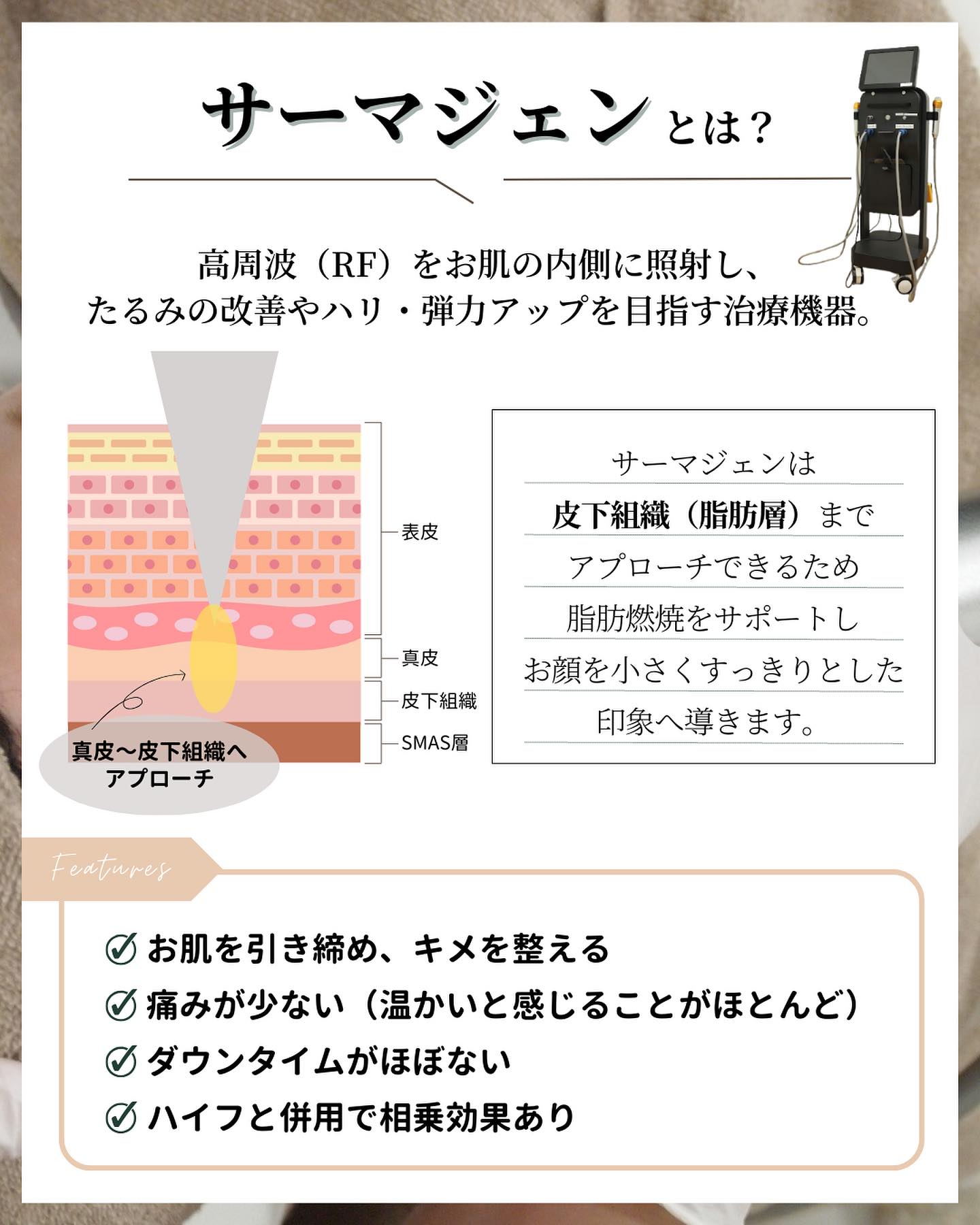 サーマジェン　とは