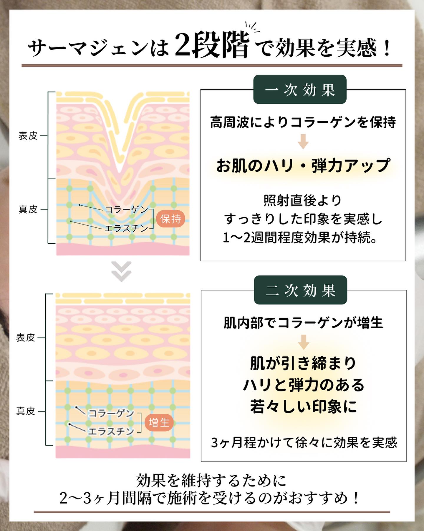 サーマジェン　効果　いつから