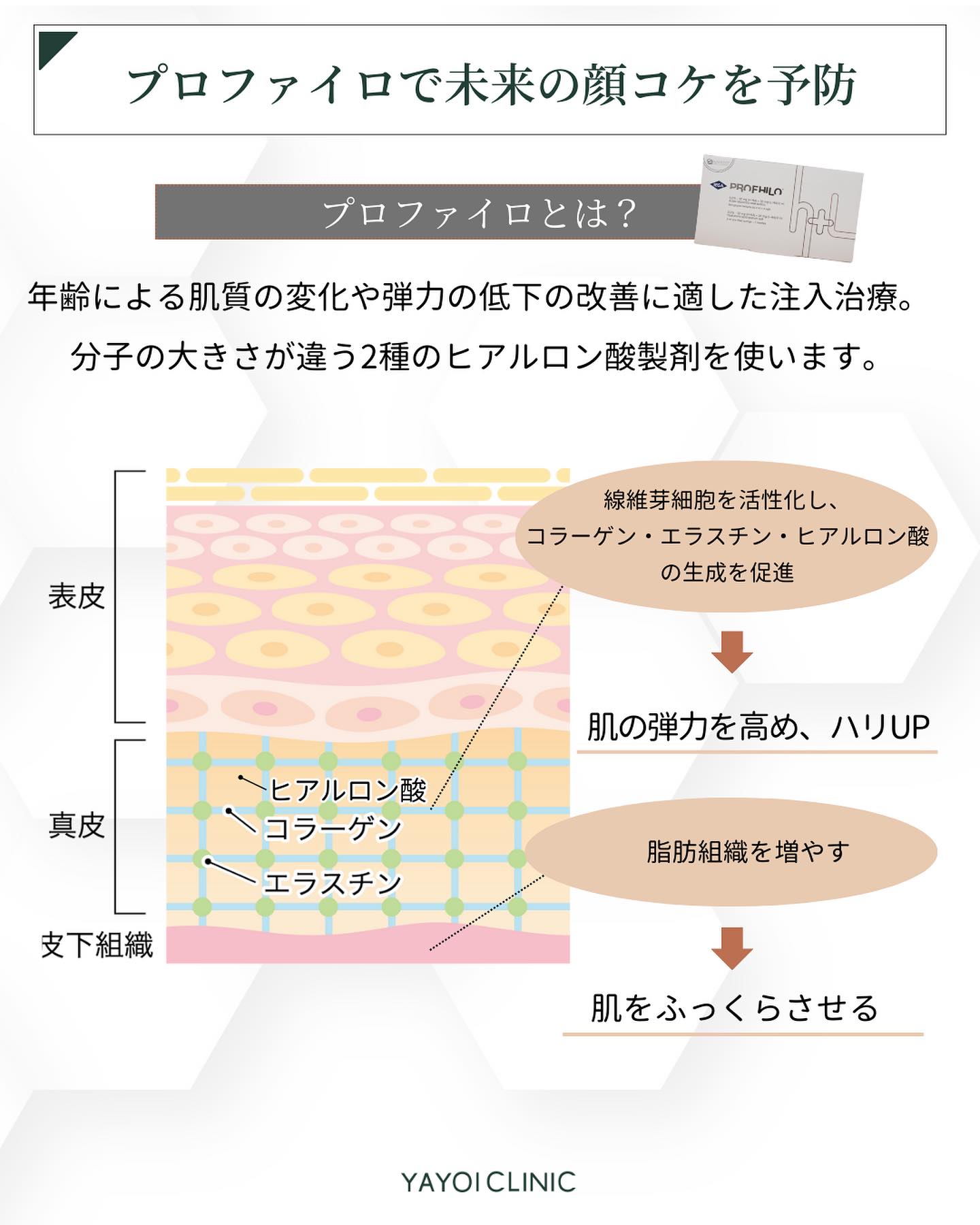 プロファイロ　顔のコケ　予防