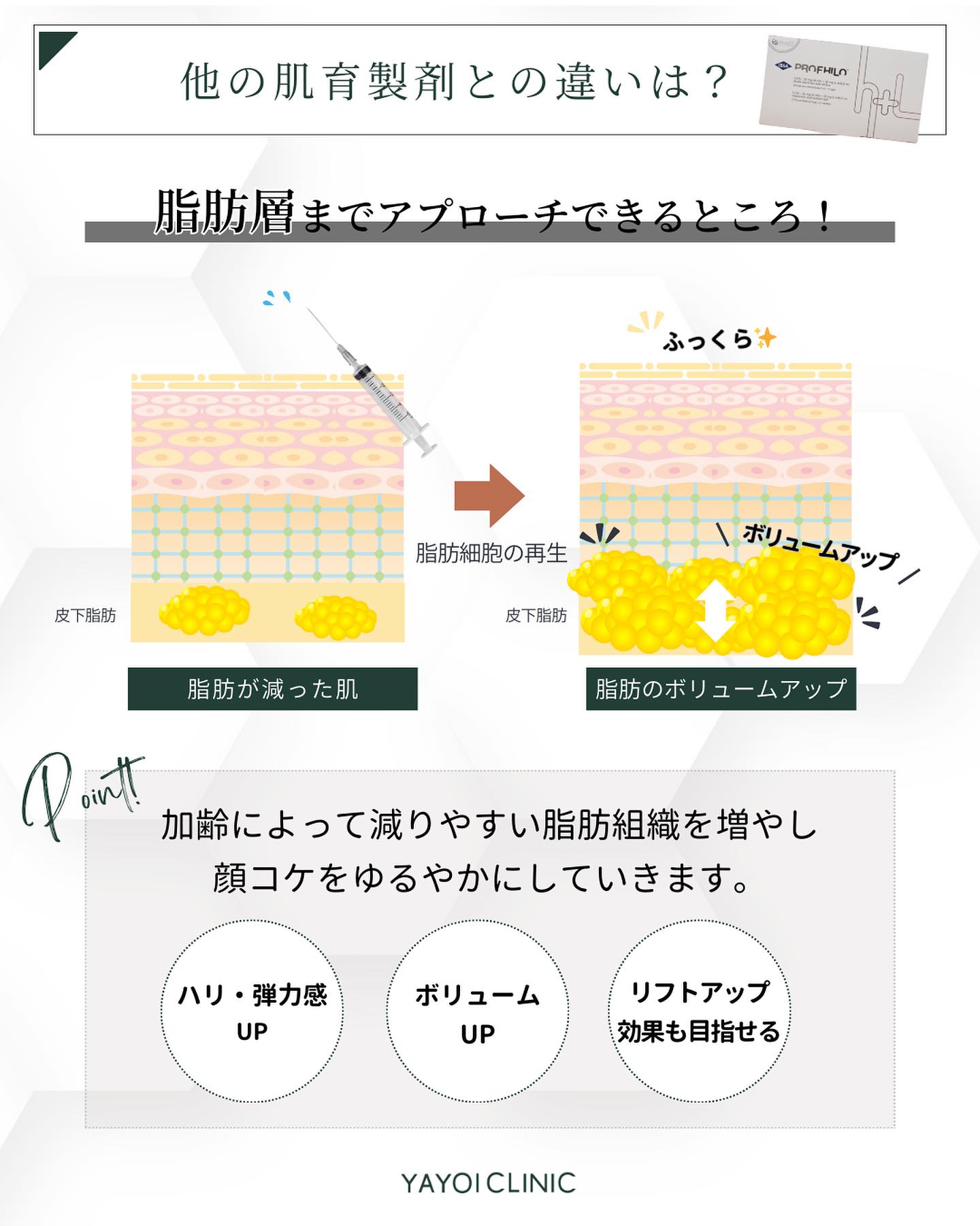 プロファイロ　肌育注射　違い