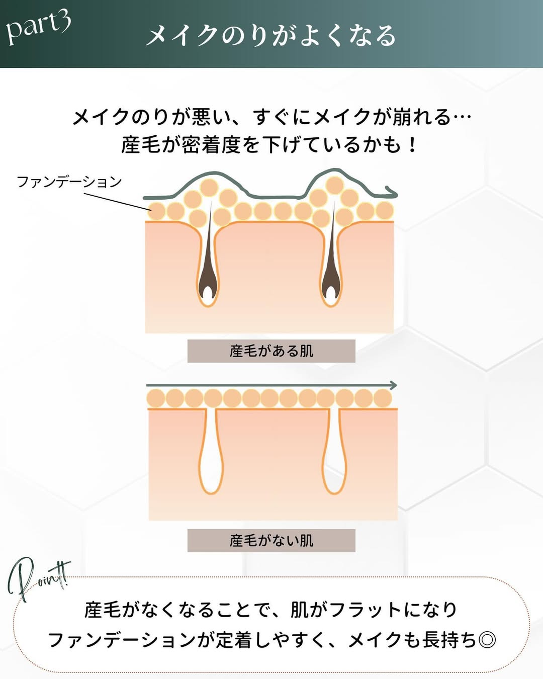 顔脱毛 メイクのり
