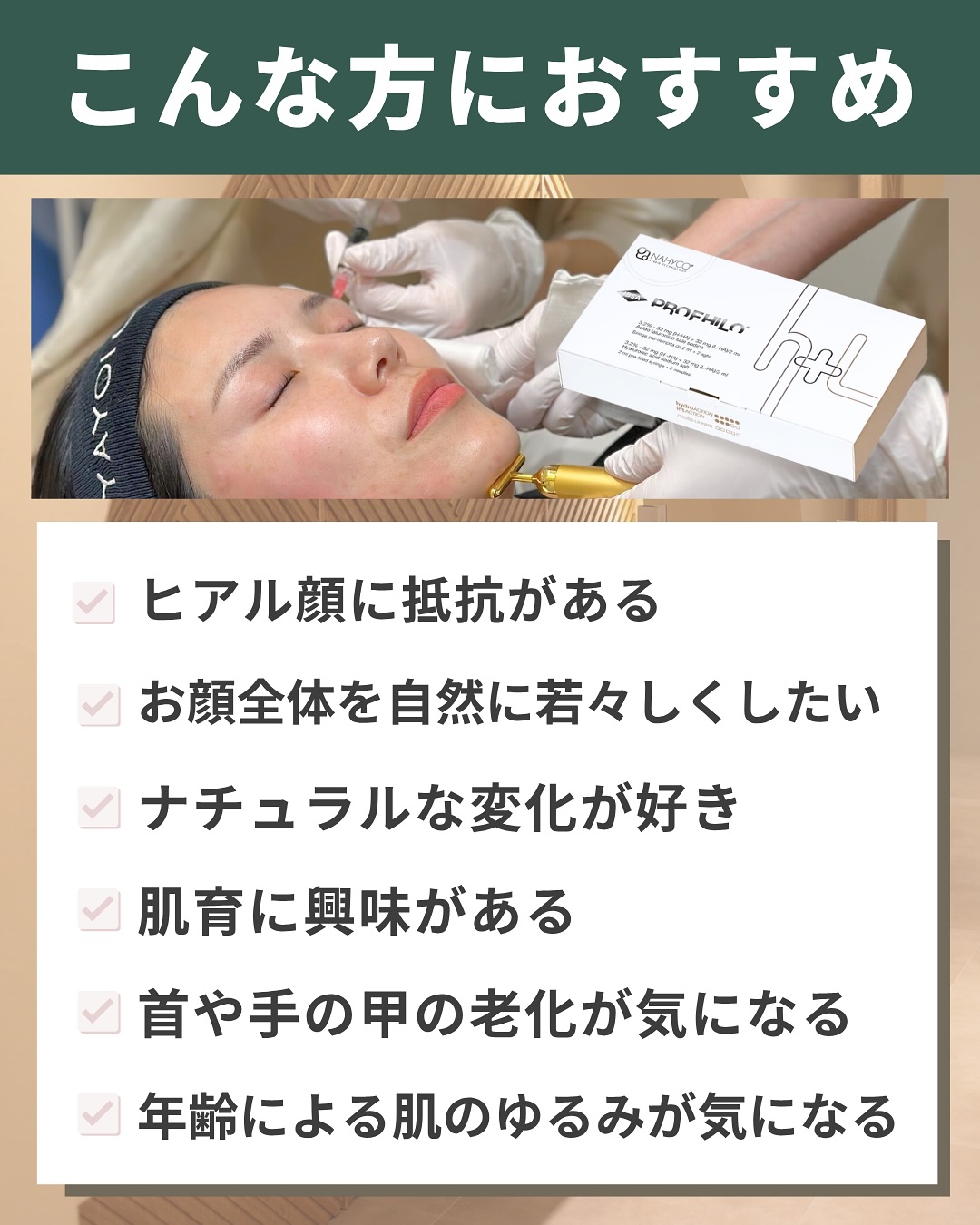 プロファイロ