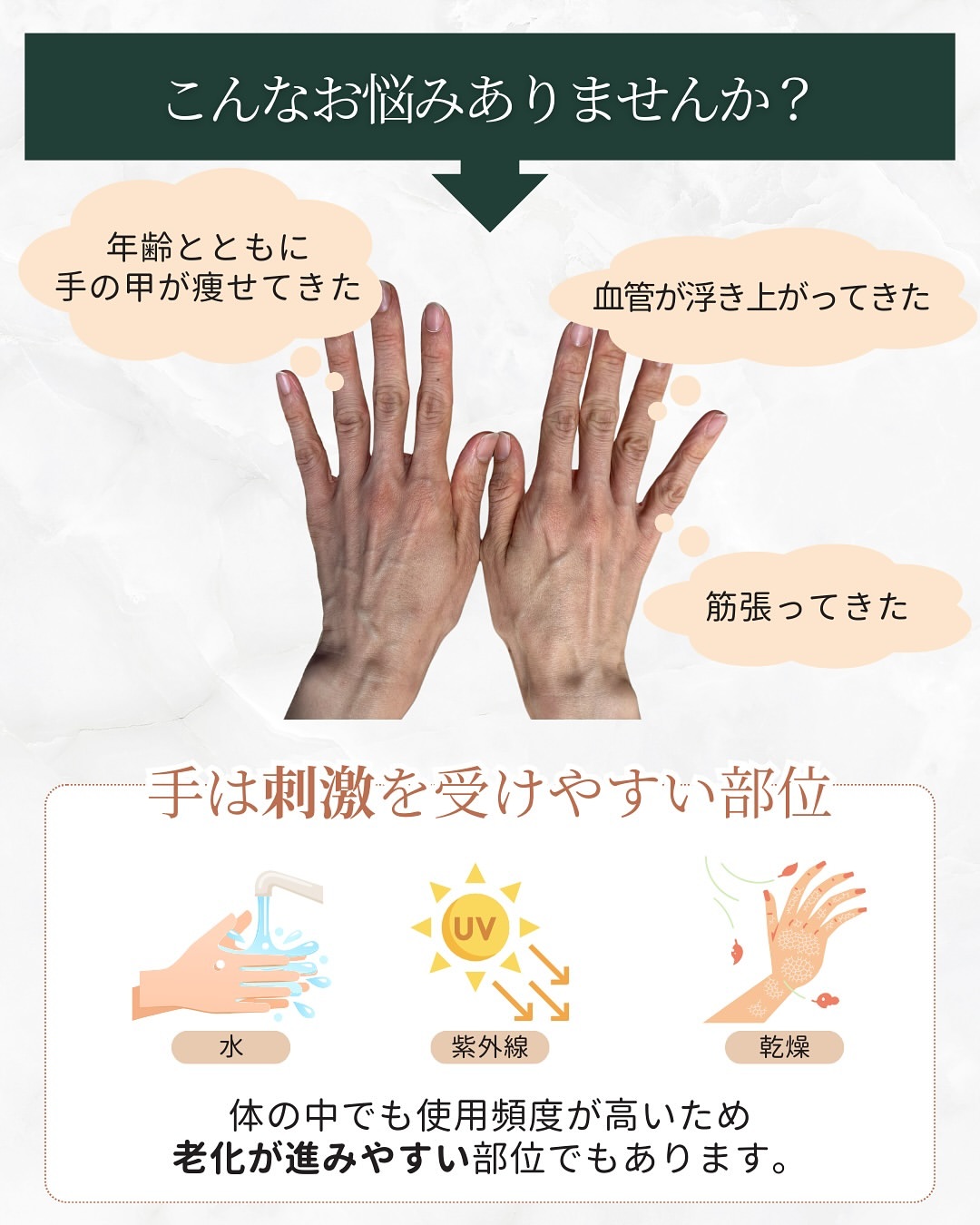 年齢とともに手の甲は痩せるなど