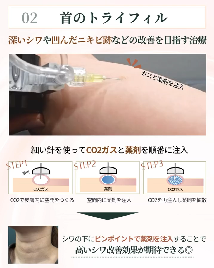 首のトライフィル