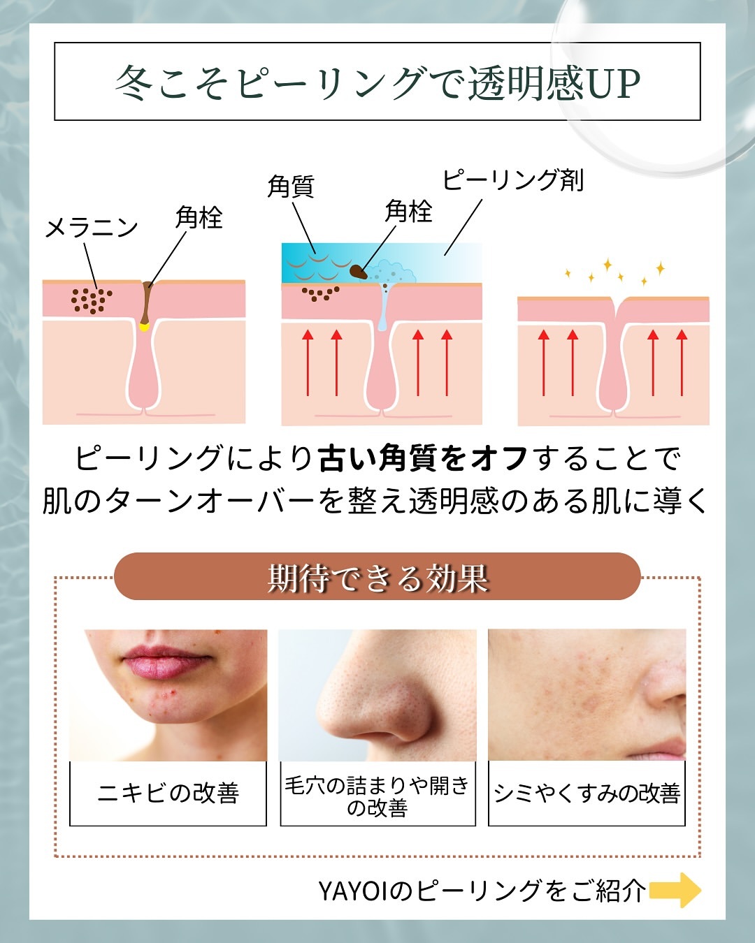 冬こそピーリングで透明感UP