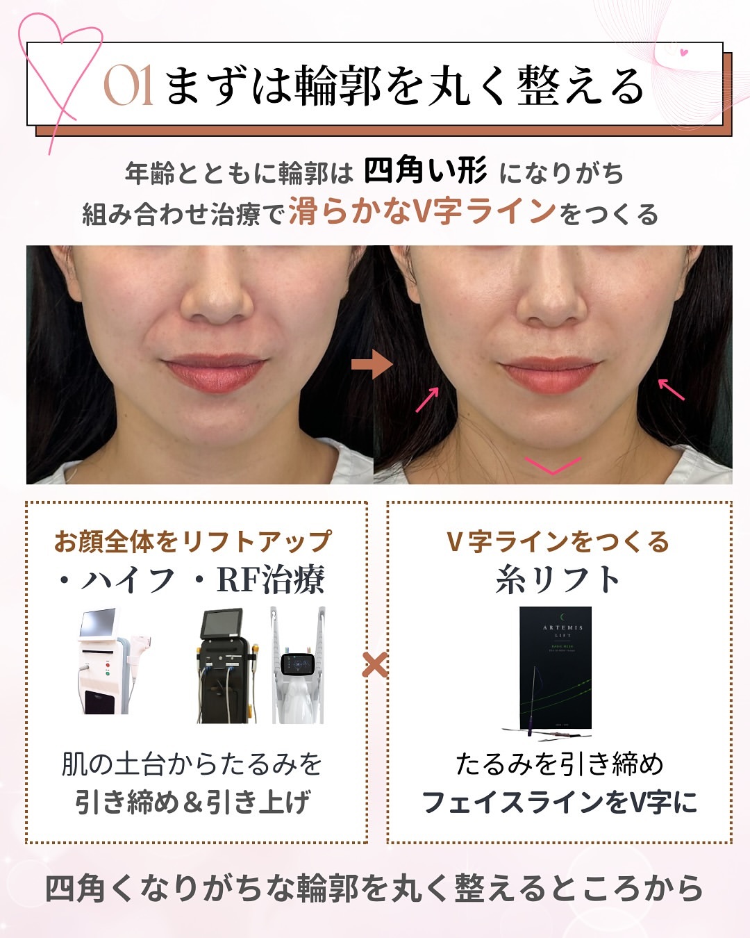 まずは輪郭を丸く整える