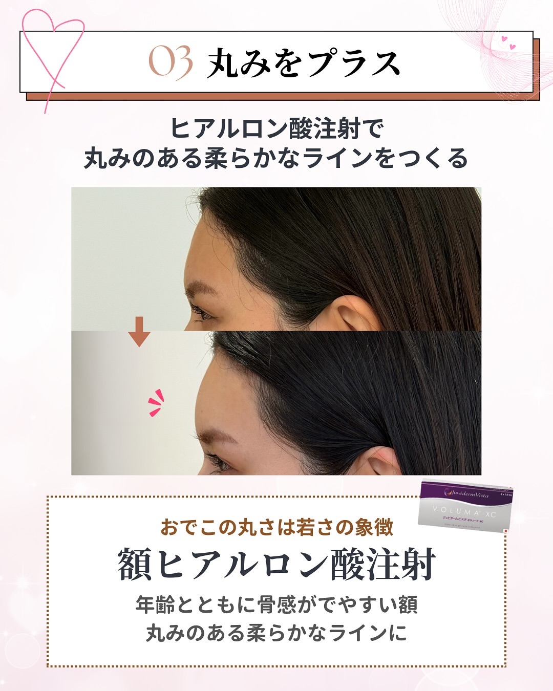 丸みをプラス