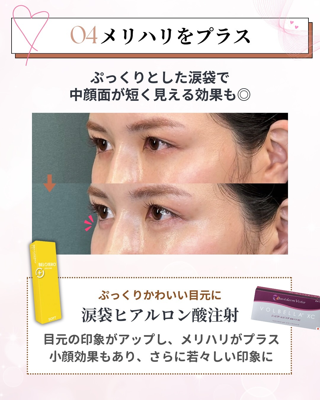 メリハリをプラス