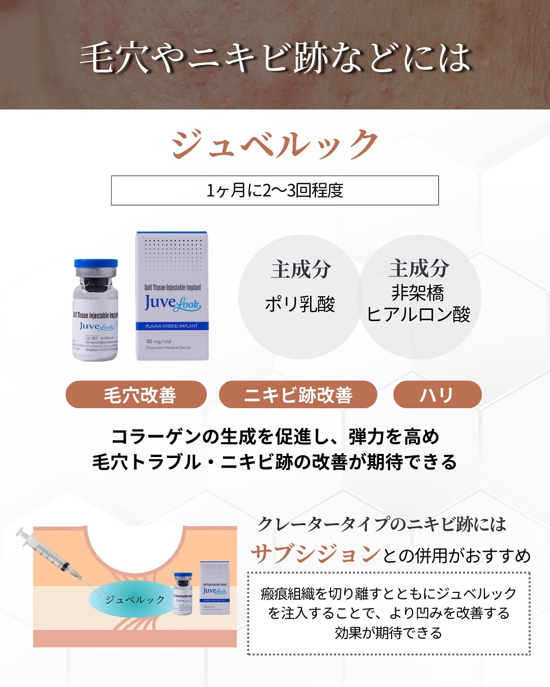 毛穴やニキビ痕にジュベルック