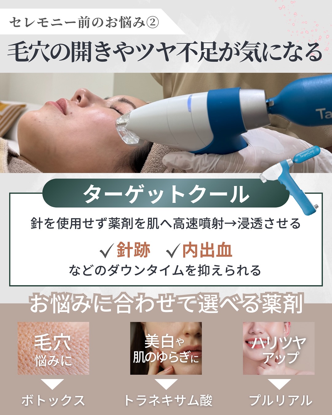 ターゲットクールとは