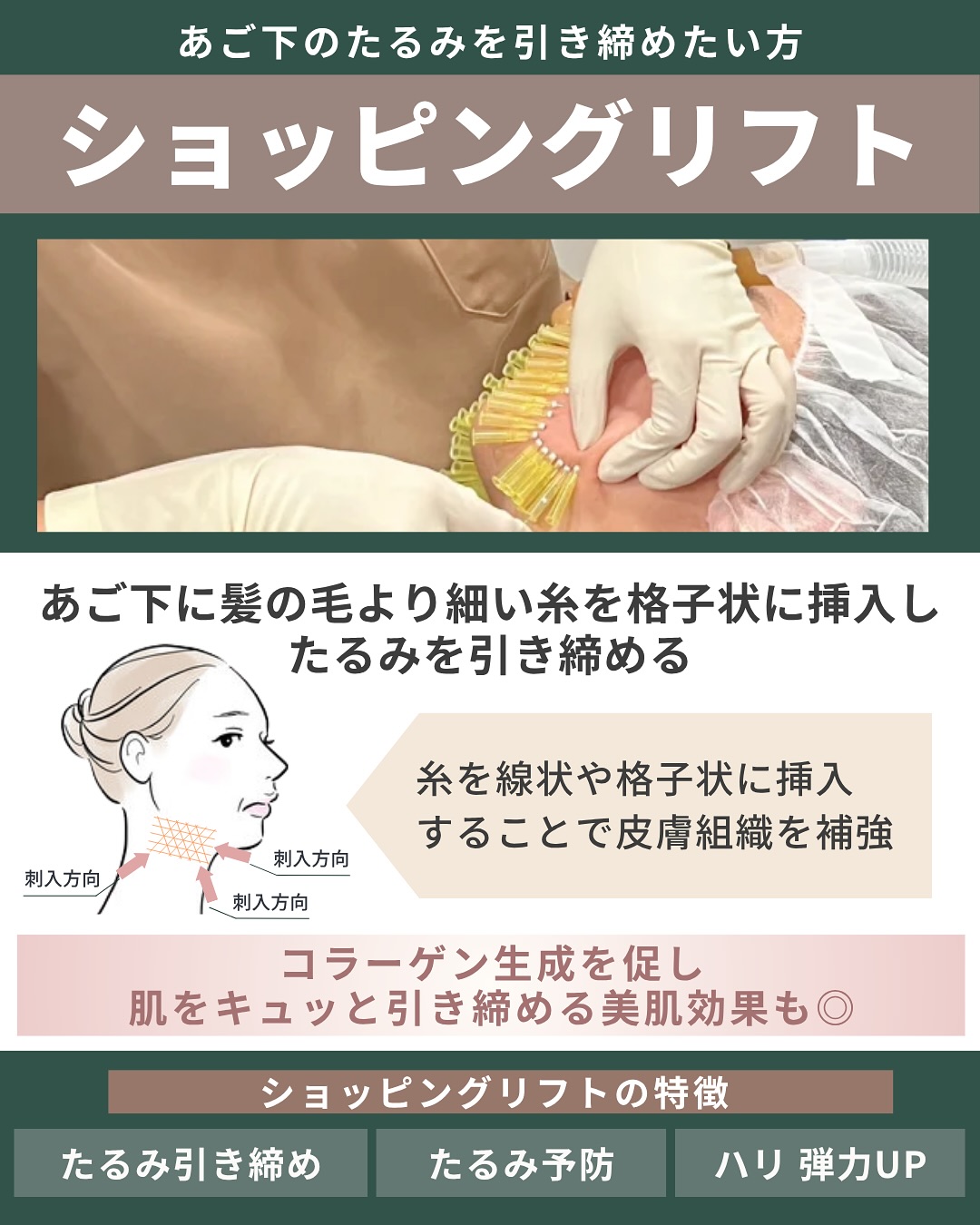 ショッピングリフト