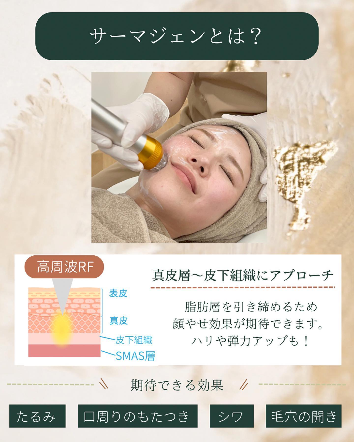 サーマジェンの仕組みと効果