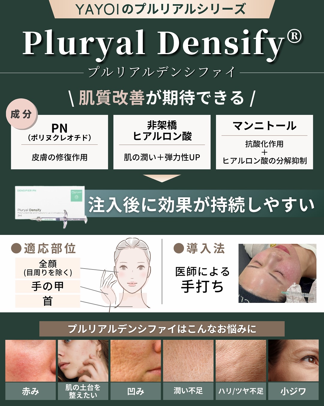 プルリアルデンシファイとは