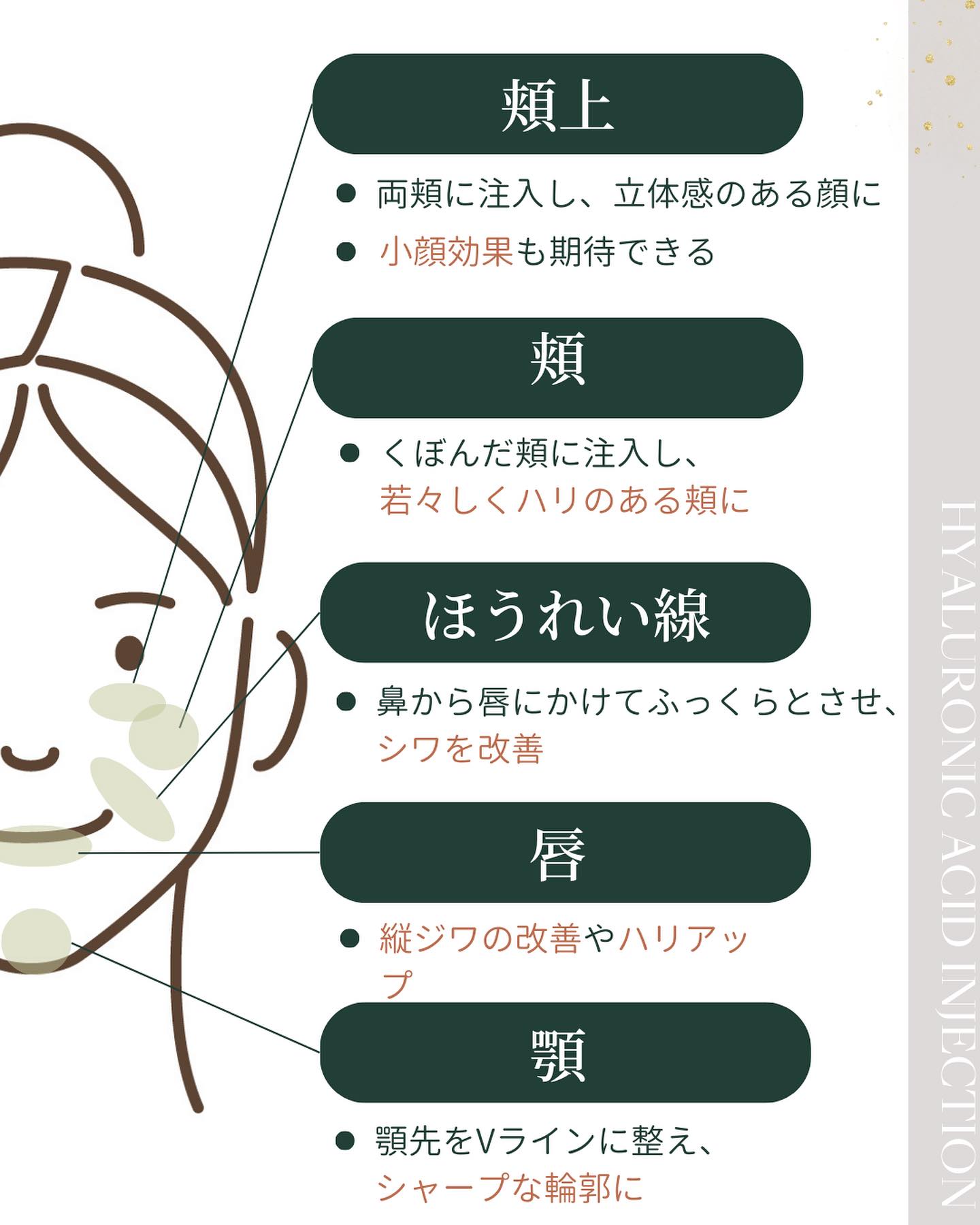 ヒアルロン酸注射ができる顔下部