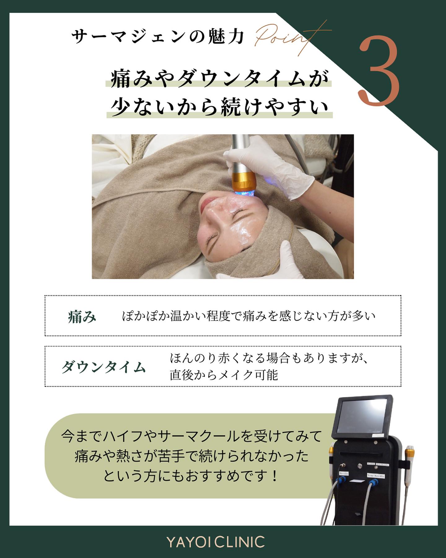 サーマジェンの魅力｜ダウンタイムが短い