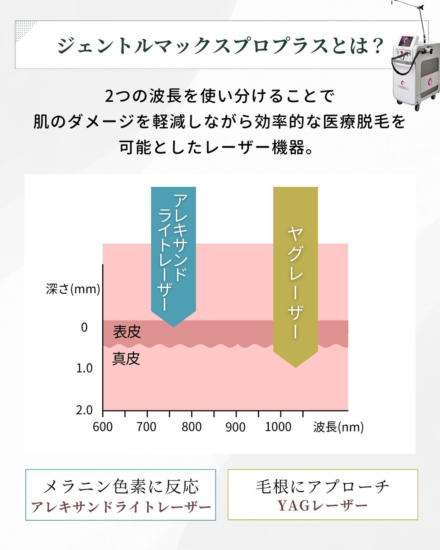 ジェントルマックスプロプラスとは