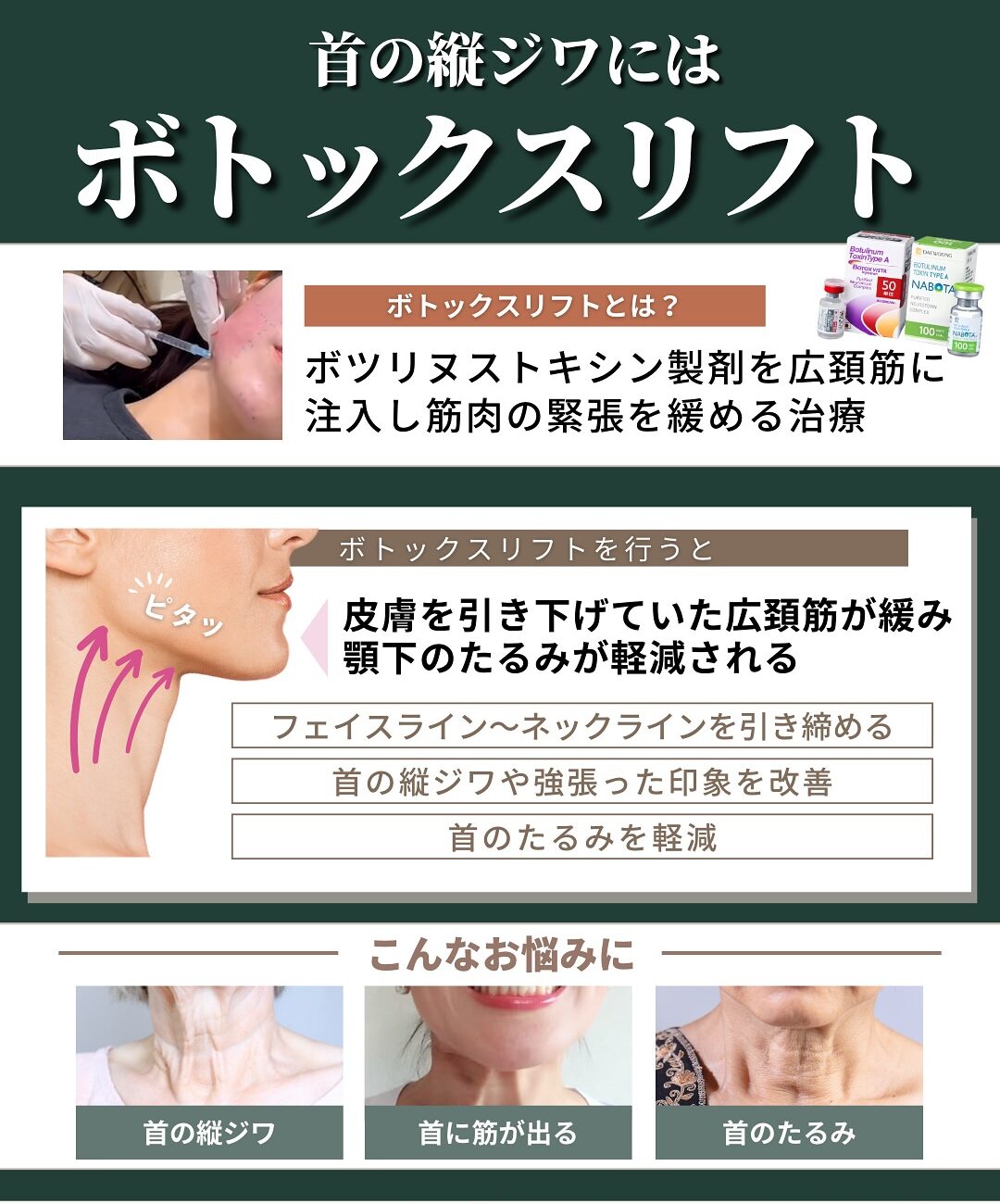 首の老化やシワが気になる方へ！縦ジワ・横ジワの原因と施術法を解説