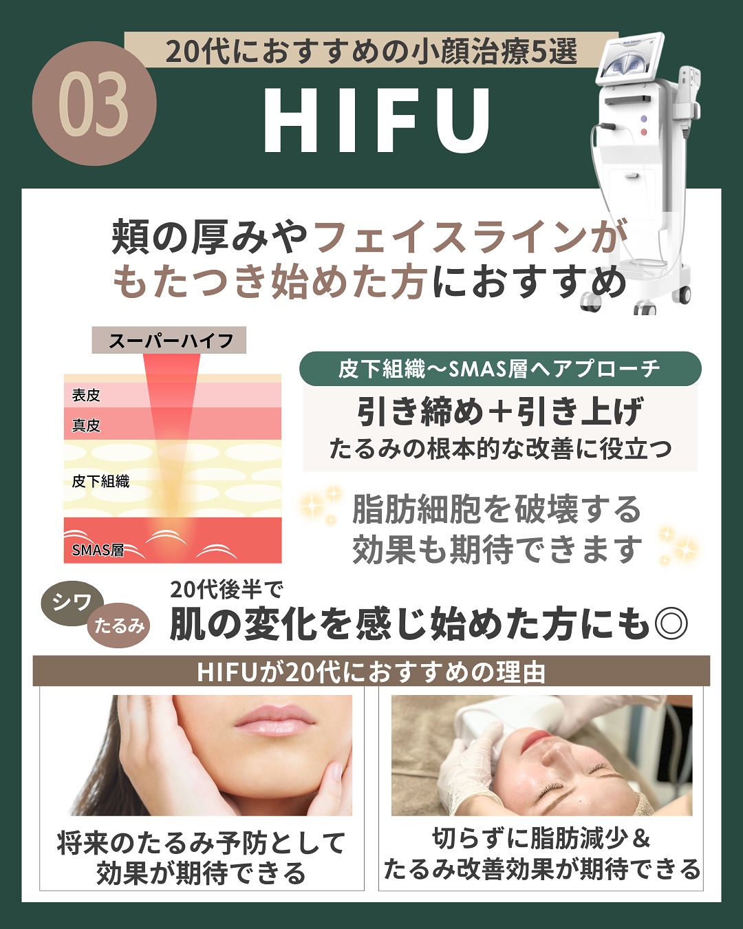 HIFU（ハイフ）