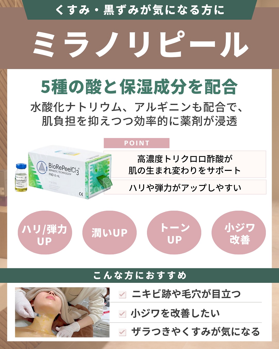 ミラノリピール