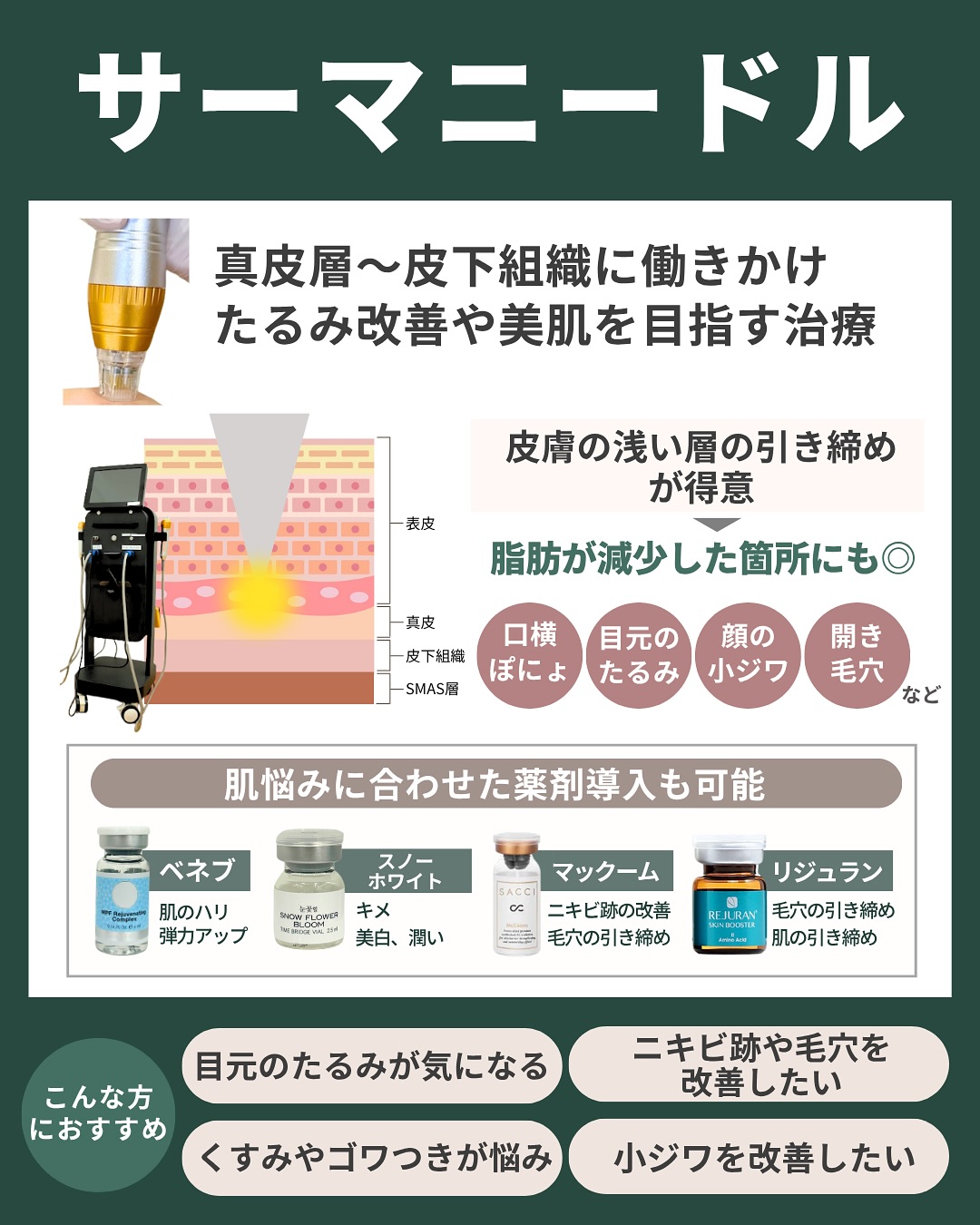 サーマニードル