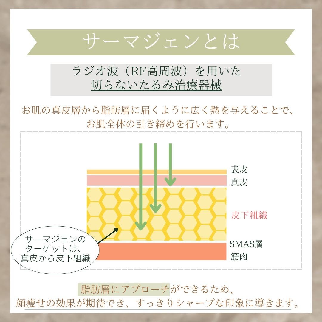 サーマジェンとは