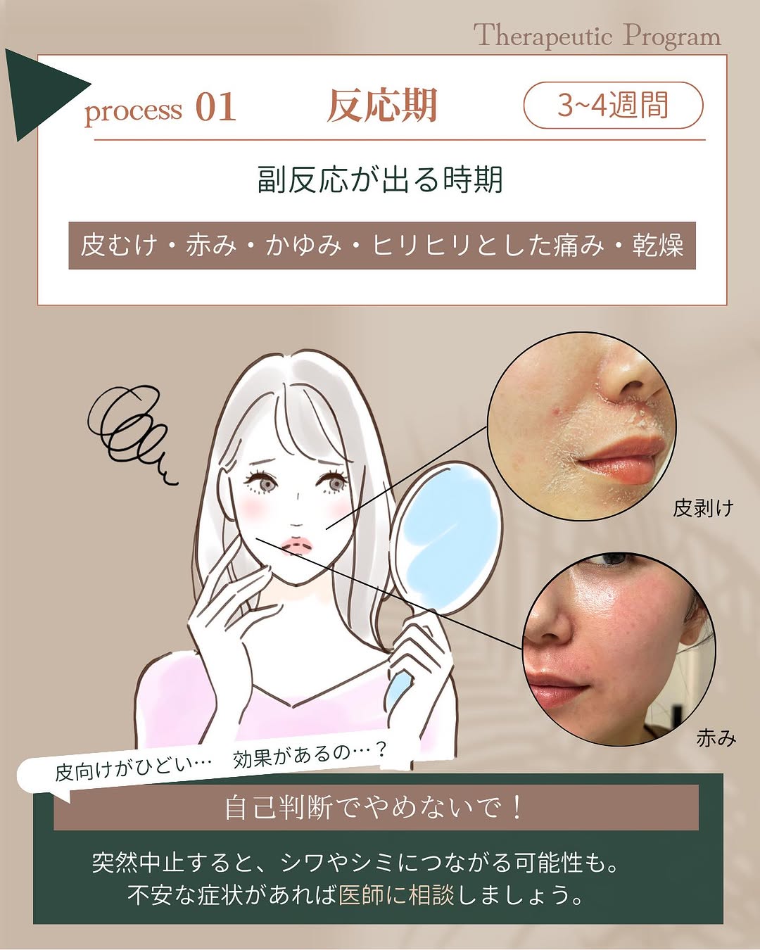 セラピューティックプログラム反応期