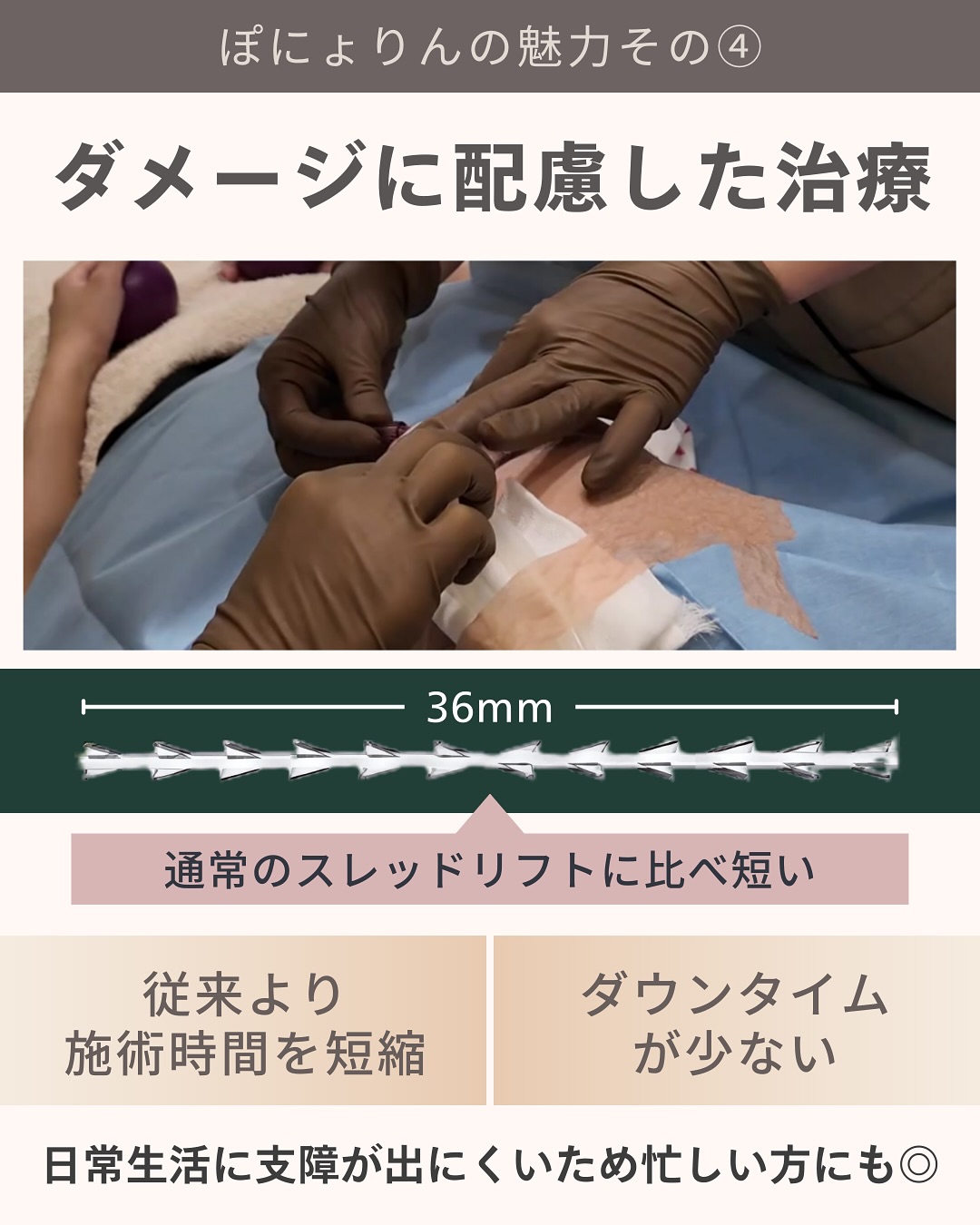 ぽにょりん ダメージに配慮した治療