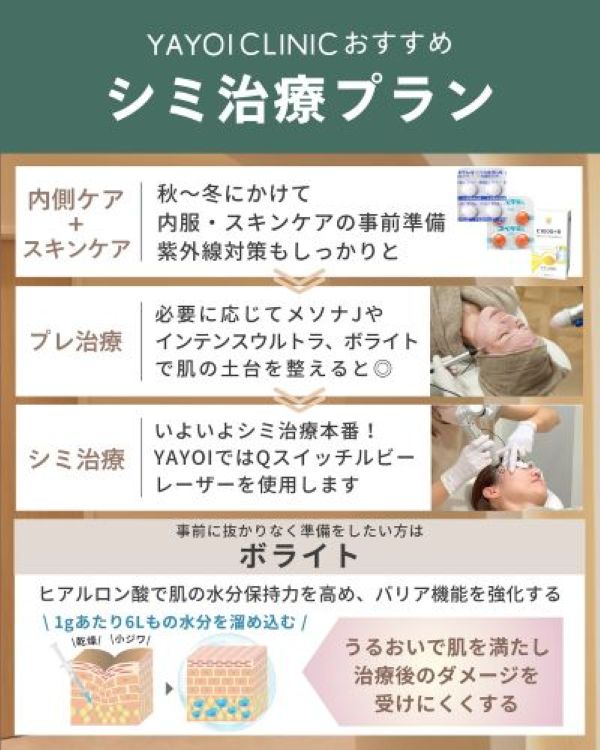 シミ治療プランの詳細