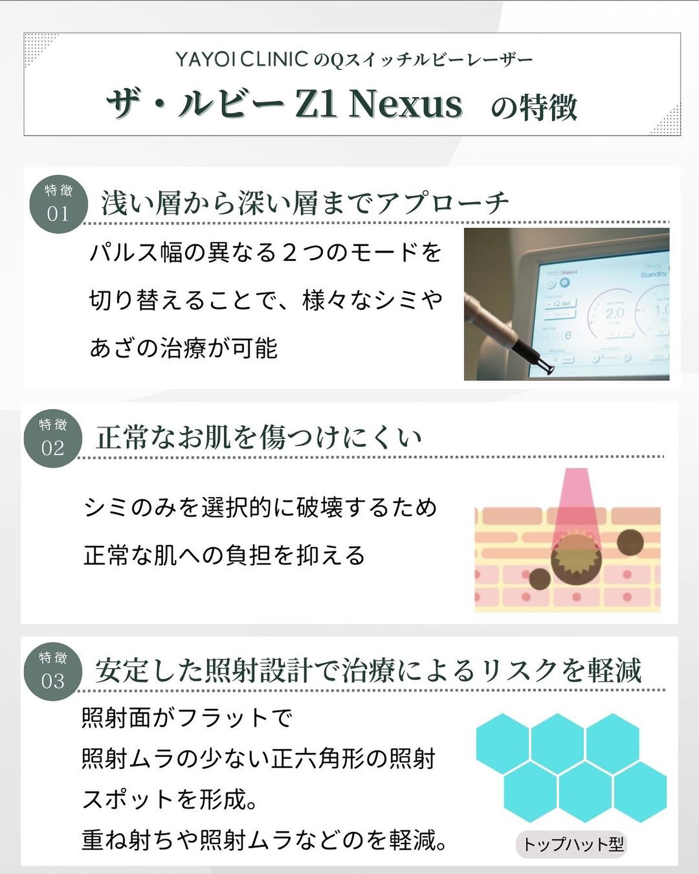 Qスイッチルビーレーザーの特徴