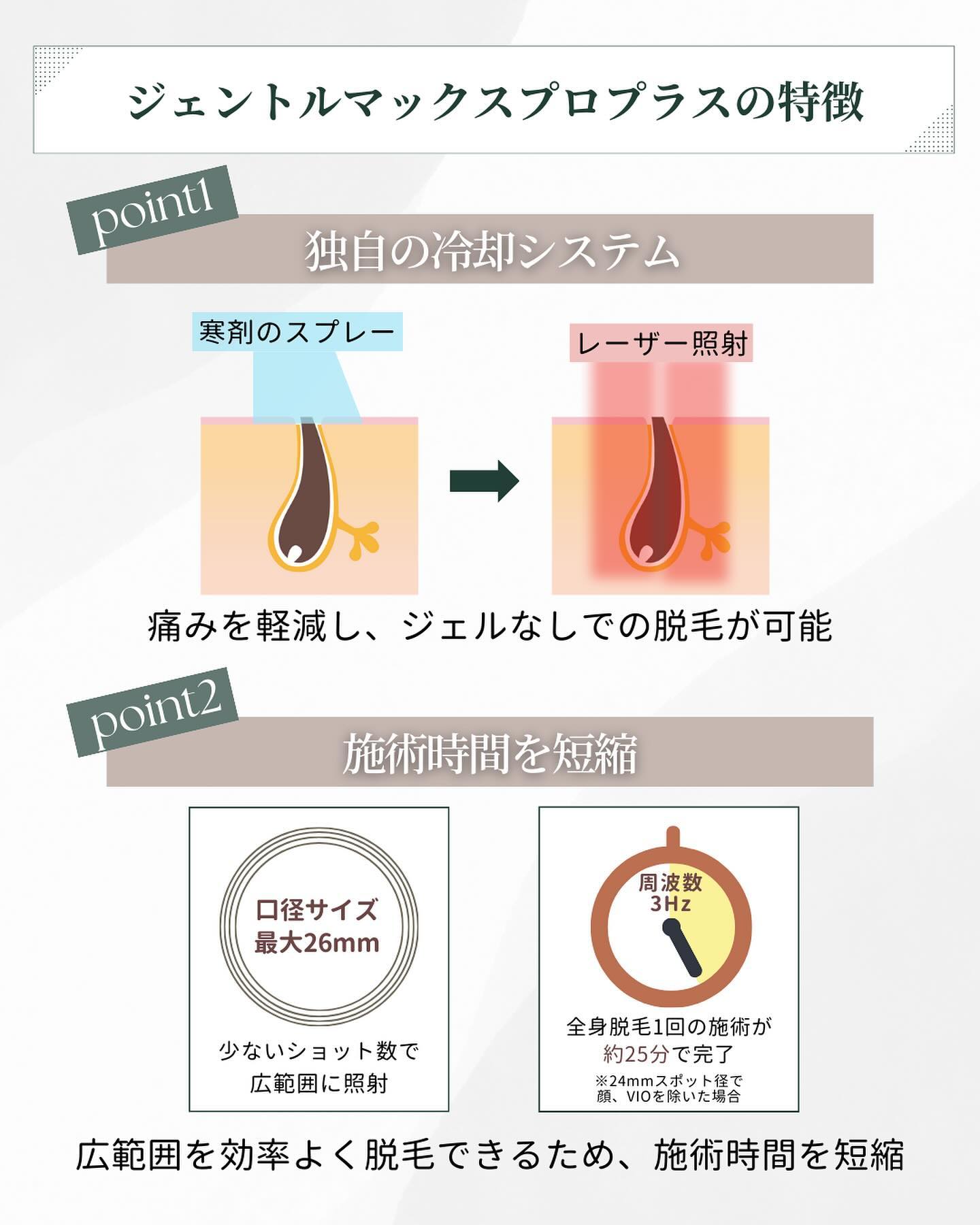 ジェントルマックスプロプラスの特徴