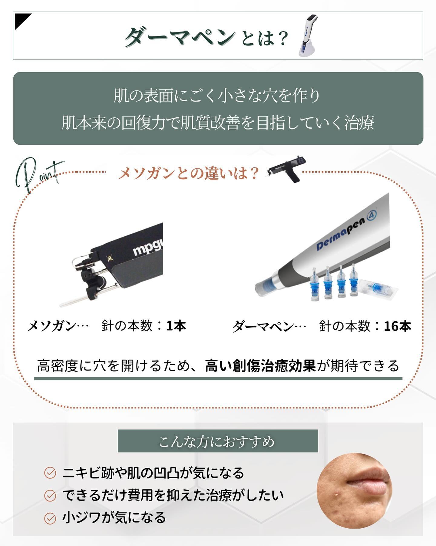 針の美容施術 ダーマペン