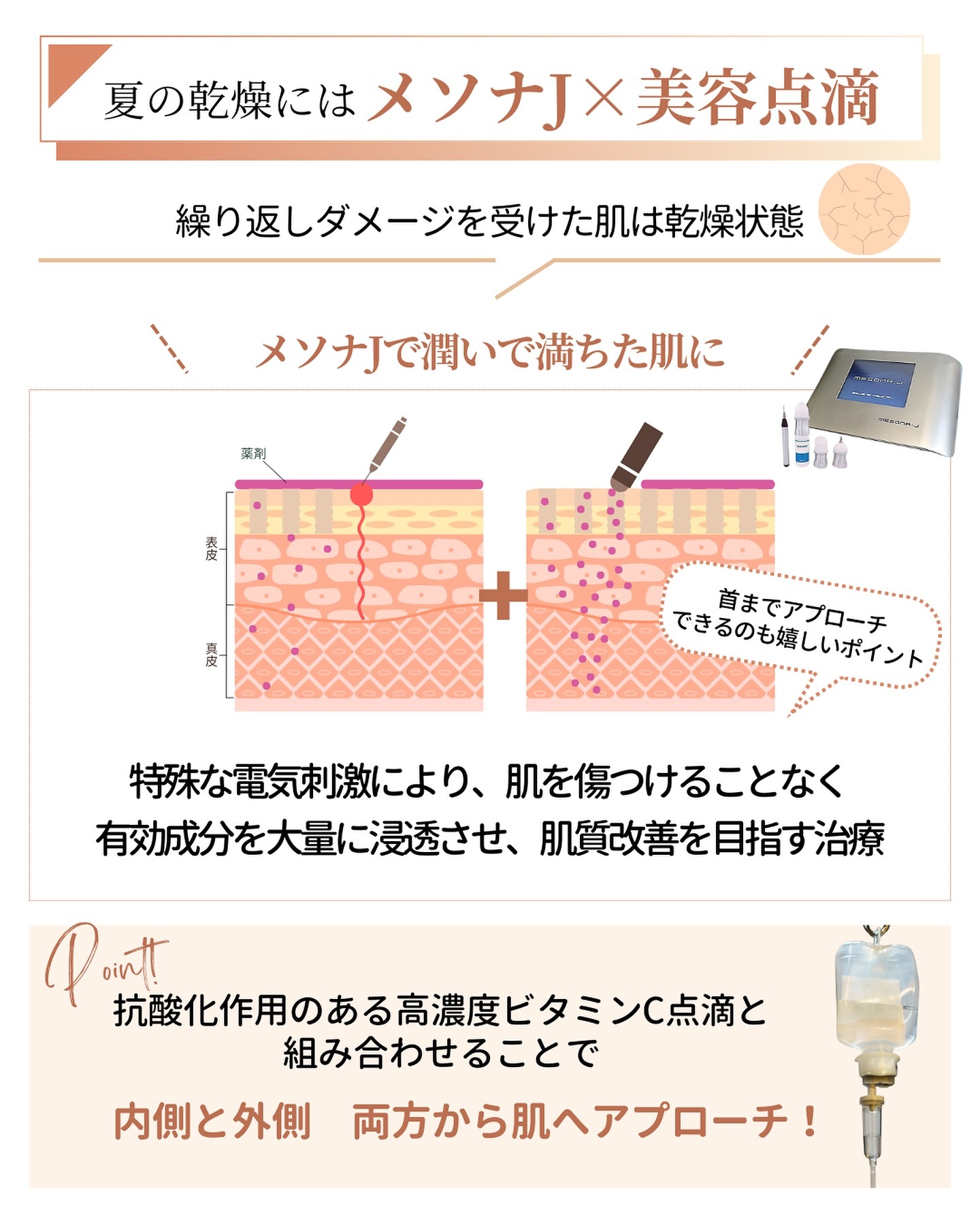 メソナJと美容点滴の特徴や効果