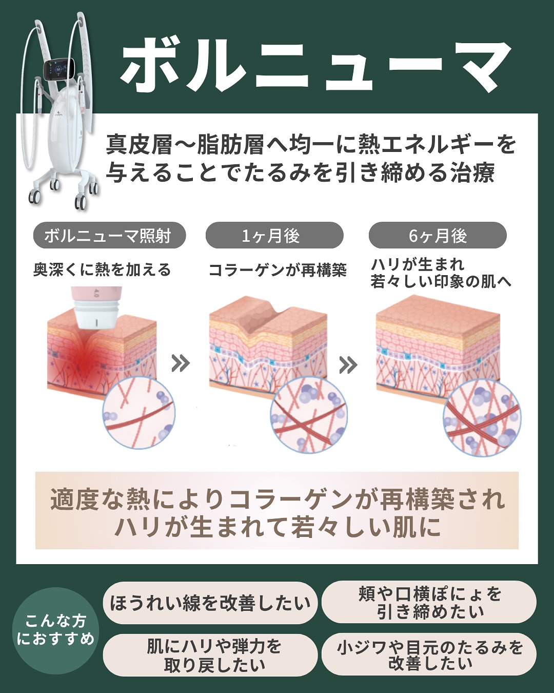 ボルニューマ