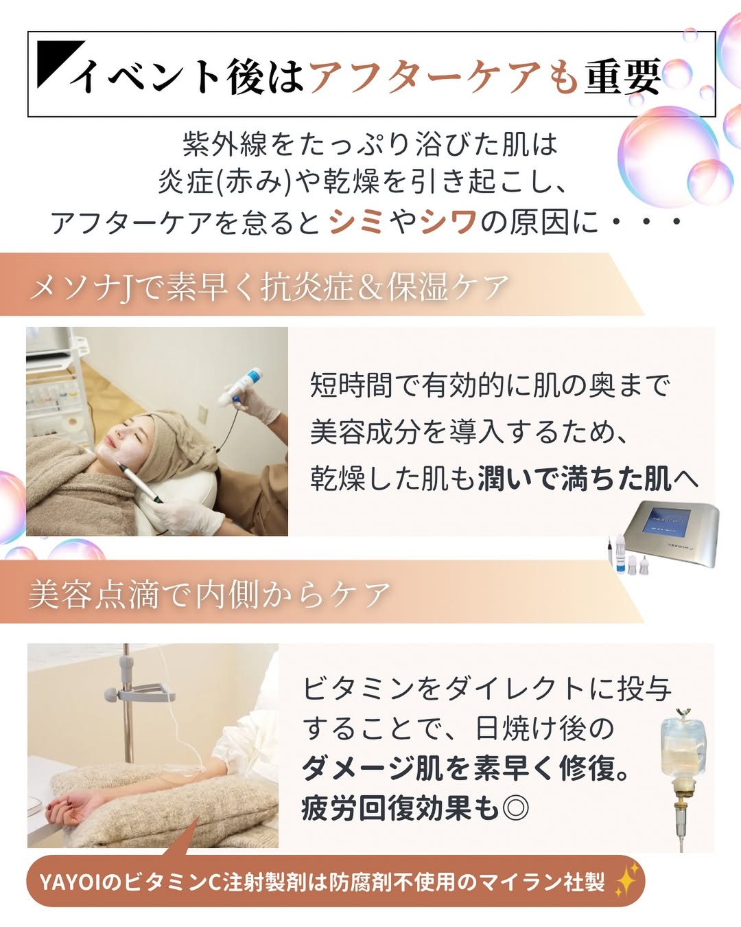 イベント後はアフターケアも重要