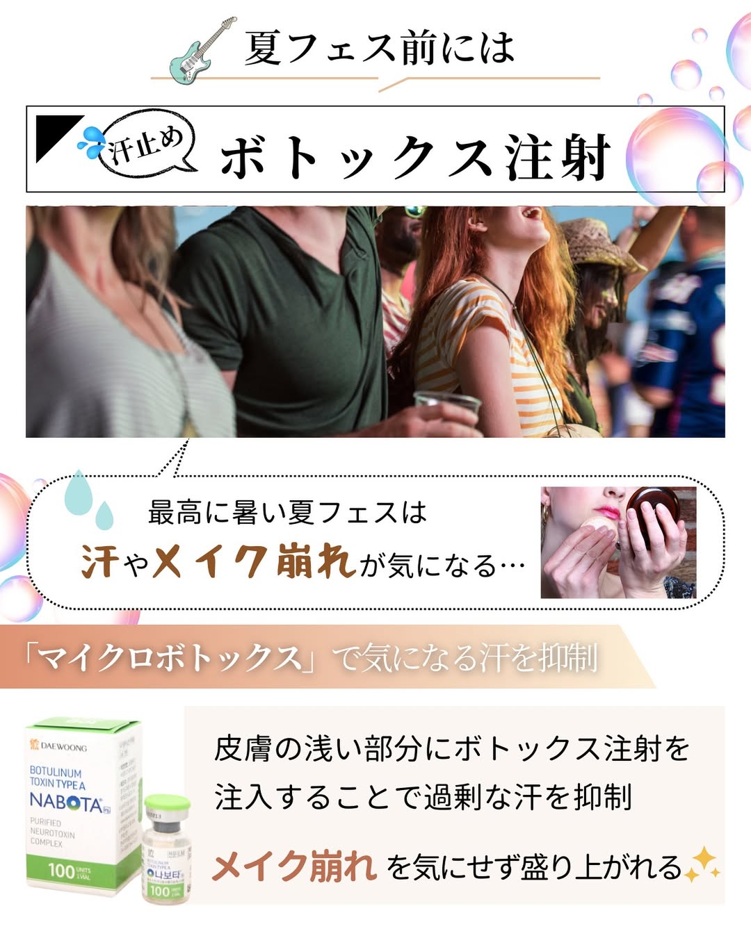 夏フェス前にはボトックス注射