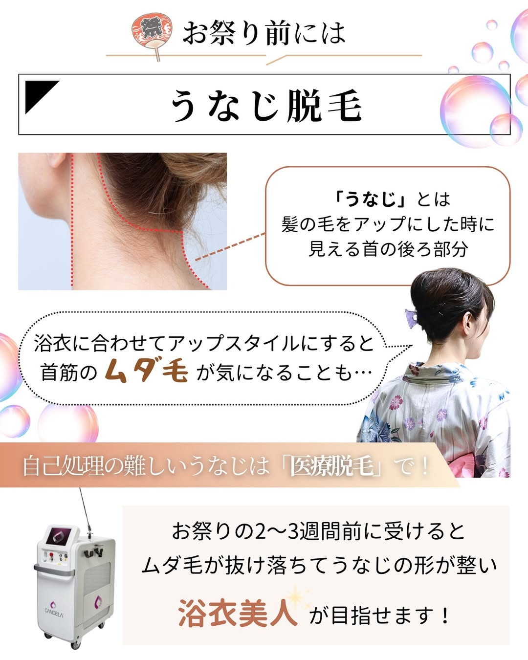 お祭り前にはうなじ脱毛