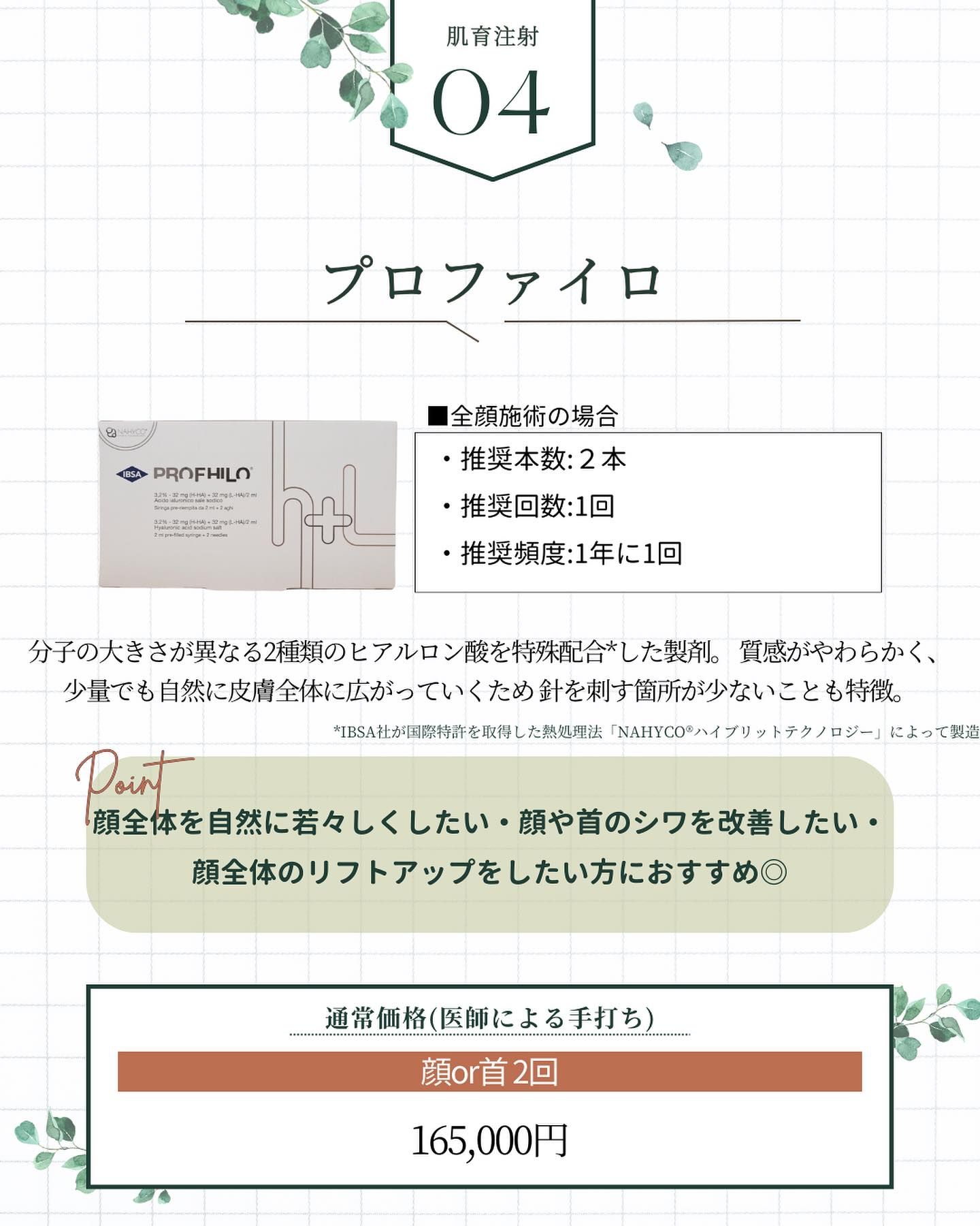 プロファイロの特徴