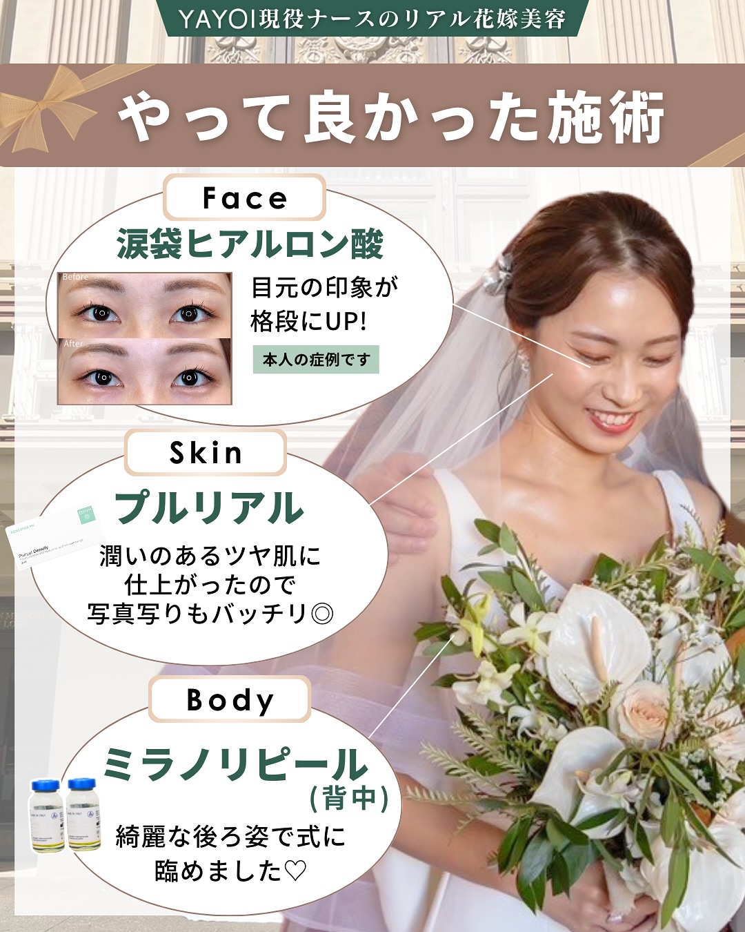 花嫁美容でやってよかった施術