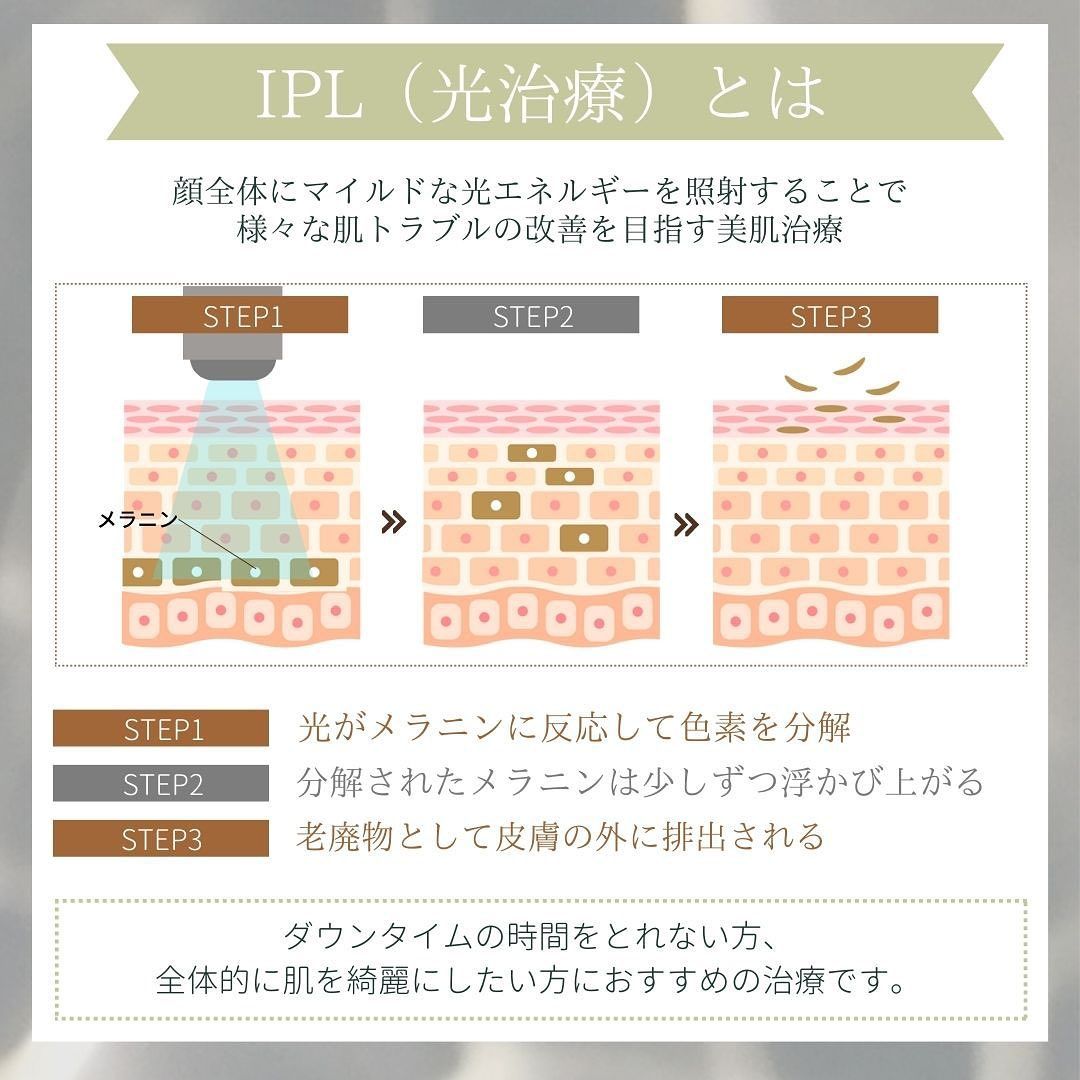 IPL(光治療)とは
