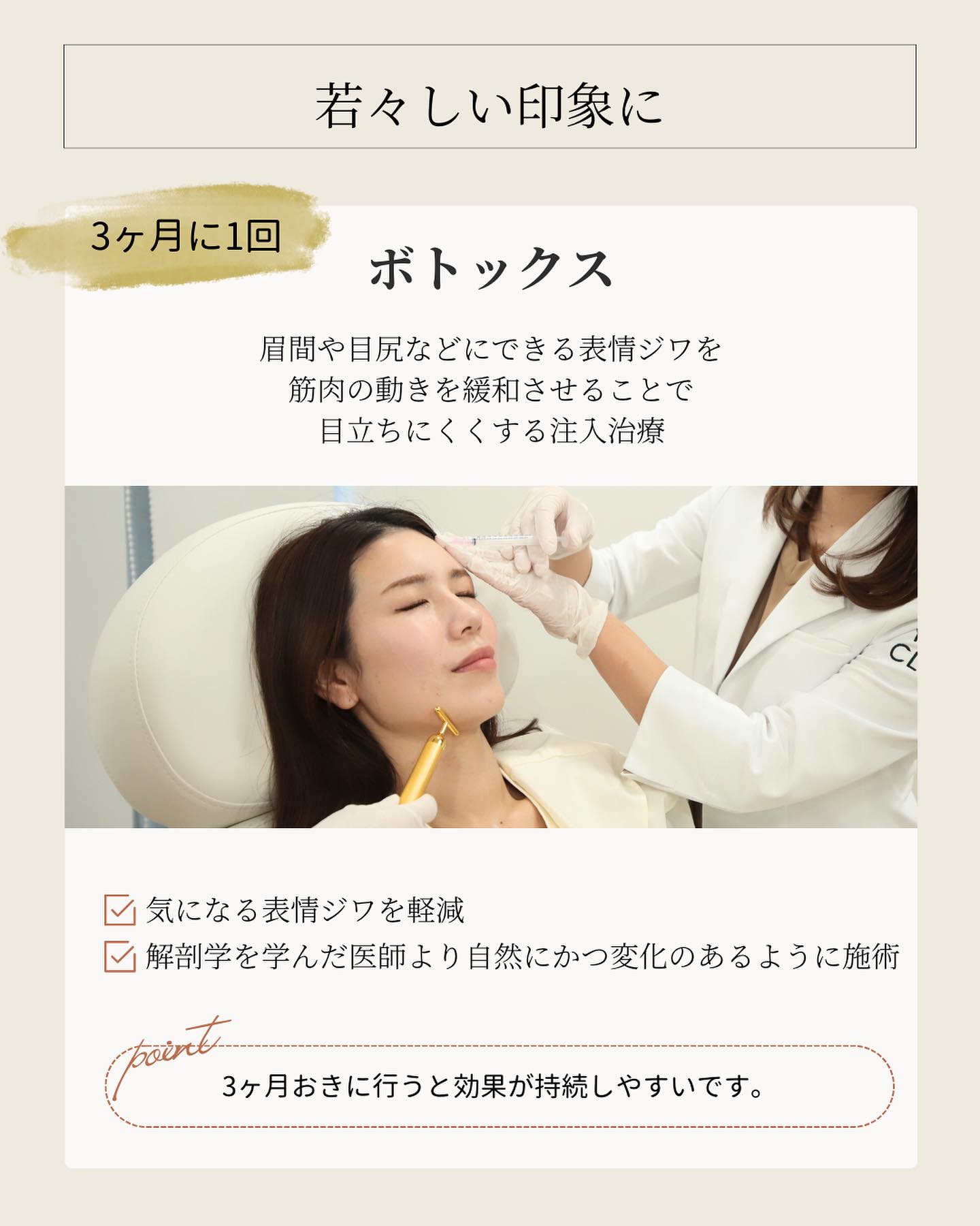 ボトックスの特徴