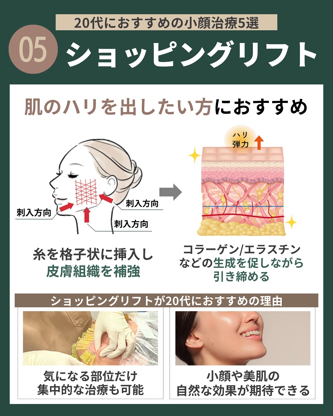 （5）ショッピングリフト