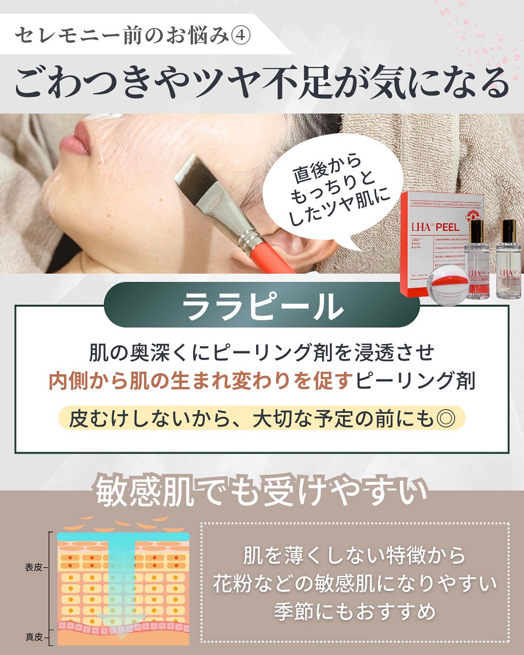 ララピールについて