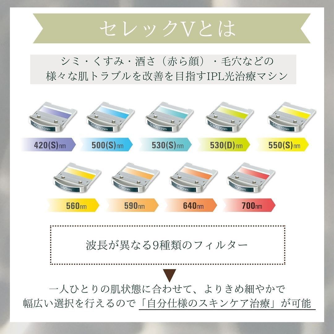 セレックVとは