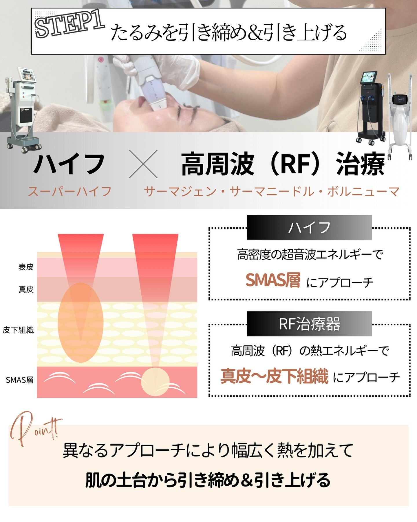 ハイフ×高周波RF